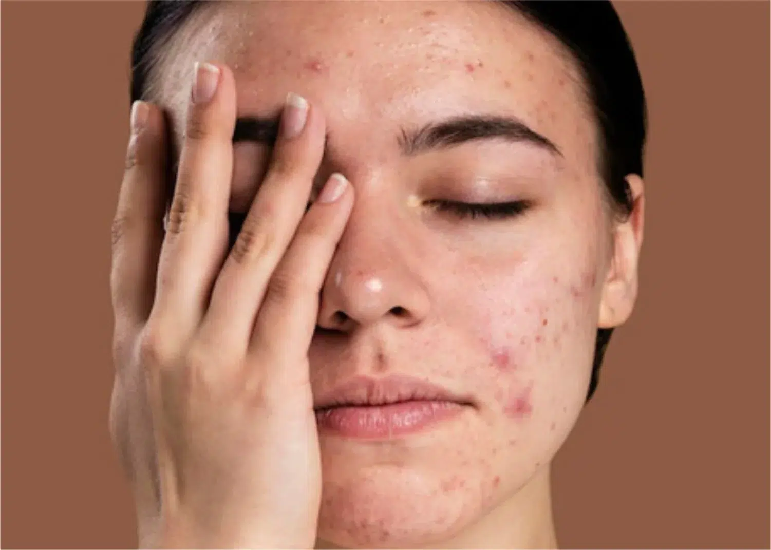 Toz Alerji Leke (2)-1