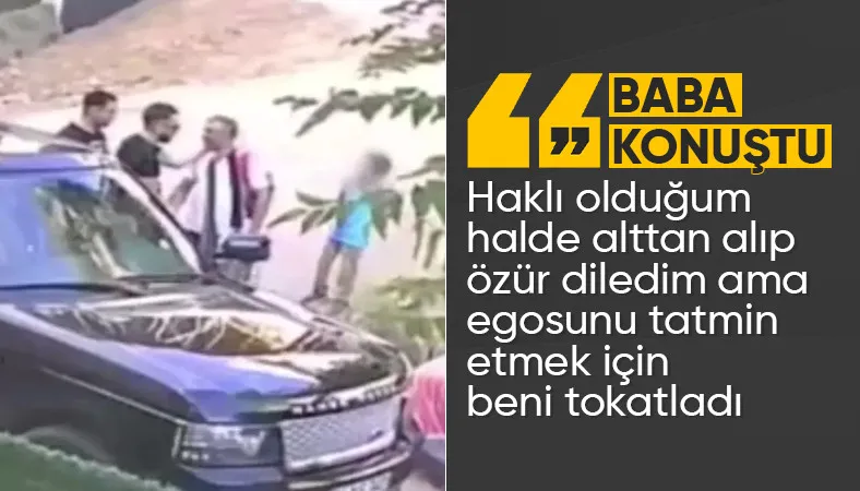 Çocuklarının Gözü Önünde Tokatlanan Baba Konuştu