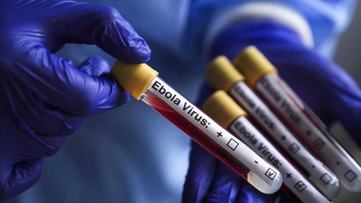 Abd, Ebola Salgını Nedeniyle Kongo Demokratik Cumhuriyeti'ndeki Vatandaşlarının Ülkeye Dönüşünü Kısıtladı