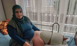 Fil hastalığı bacağını 100 kilo yaptı, tedavisinin devamı için destek bekliyor