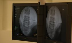 Fıtıkla uzun süre yaşamak ciddi risklere neden olabiliyor