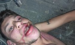 Hamam böceği yedirilen gencin dosyasında karar: Yağmadan beraat, hürriyeti tehditten 6 yıl 12 ay ceza