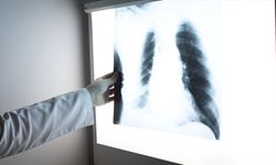 Sık yaşanan viral enfeksiyonlar akciğer kapasitesini düşürüyor