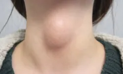 Herkes Kullanıyor: Tiroidi Tehdit Ettiği Ortaya Çıktı!