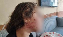 8 yaşındaki kızını darp eden çocuğun epilepsi hastası ablasını sokak ortasında dövdüğü iddiası