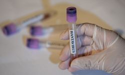 Avrupa İlaç Ajansı: Hantavirüs için onaylı tedavi ve aşı yok