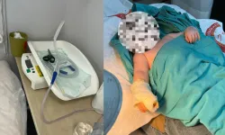 Hatay'da Hastanede Şok İddia: 5 Aylık Bebeğin Parmağı Kesildi !