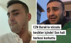 CZN Burak'ın Son Hali Herkesi Korkuttu