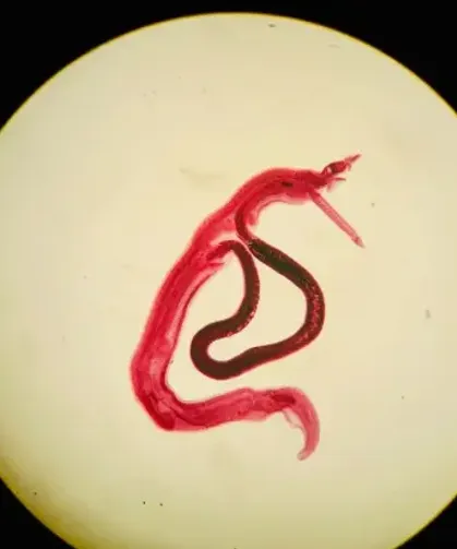 Hatay'da Cinsel Yolla Bulaşan Enfeksiyon Alarmı: Uzmanlardan Hastalık Uyarısı