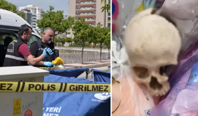 Çöpte Bulunan Kafatasının Sırrı Çözüldü!