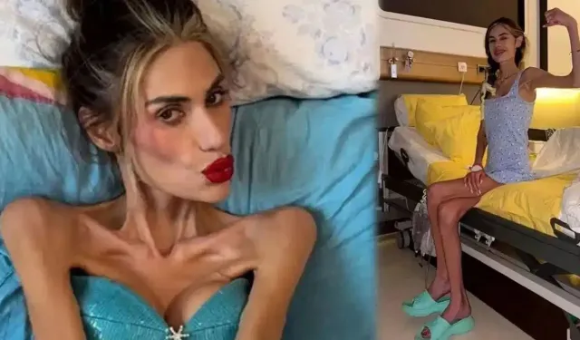 Ünlü Fenomen Hayatını Kaybetti! Nedir Bu Anoreksiya Nervoza?
