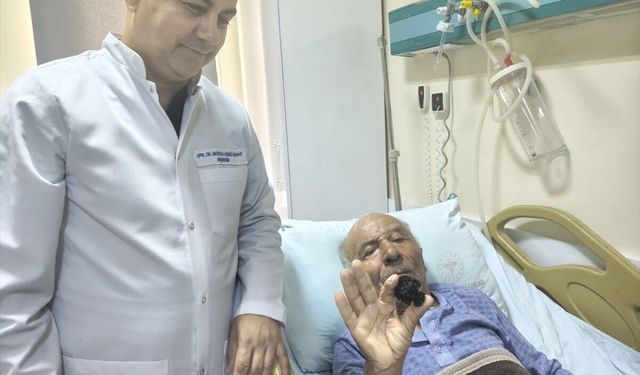 Mersin'de 67 yaşındaki hastanın mesanesinden 4 santimetrelik taş çıkarıldı