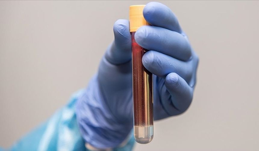 Kardeşinde prostat kanseri öyküsü olanlara 45 yaşından itibaren tarama önerisi