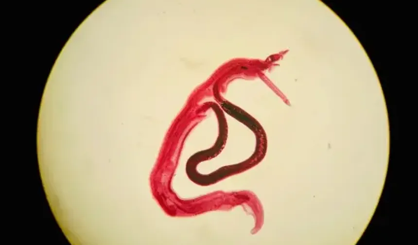 Hatay'da Cinsel Yolla Bulaşan Enfeksiyon Alarmı: Uzmanlardan Hastalık Uyarısı